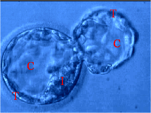 Overview of the Blastocyst development and grading ( along with Images)